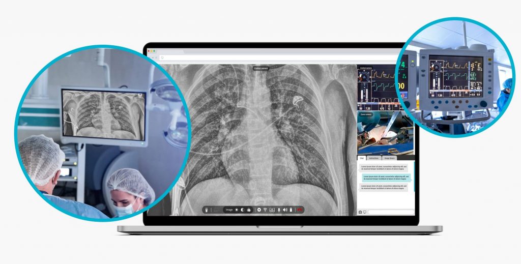 Rods&Cones Solution Revolutionizing Communication In The OR