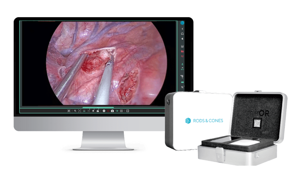Rods&Cones Medical Smart Glasses & Remote Surgical Collaboration